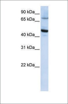 Anti-CYP46A1 antibody produced in rabbit affinity isolated antibody