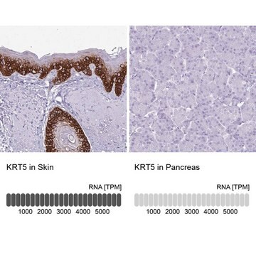 Anti-KRT5 antibody produced in rabbit Prestige Antibodies&#174; Powered by Atlas Antibodies, affinity isolated antibody, buffered aqueous glycerol solution