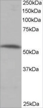 Anti-PPP2R5A antibody produced in goat affinity isolated antibody, buffered aqueous solution