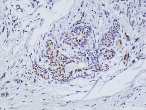 Anti-ER alpha antibody, Rabbit Monoclonal recombinant, expressed in HEK 293 cells, clone RM292, purified immunoglobulin