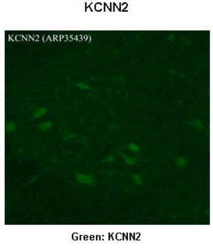 Anti-KCNN2 antibody produced in rabbit affinity isolated antibody