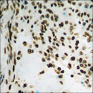 Anti-phospho-JAK1 (pTyr1022) antibody produced in rabbit affinity isolated antibody