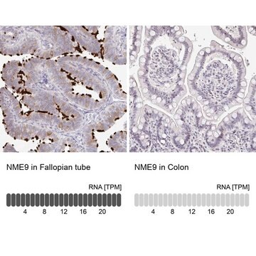 Anty-NME9 Prestige Antibodies&#174; Powered by Atlas Antibodies, affinity isolated antibody, buffered aqueous glycerol solution