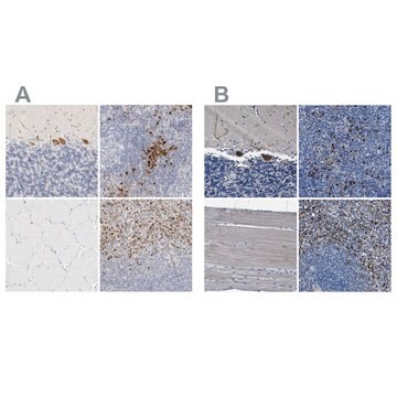 Anti-FGL2 antibody produced in rabbit Prestige Antibodies&#174; Powered by Atlas Antibodies, affinity isolated antibody, buffered aqueous glycerol solution, Ab2