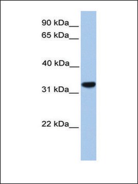 Anti-CACNG4 antibody produced in rabbit affinity isolated antibody