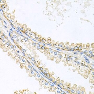 Anti-CD133 antibody produced in rabbit