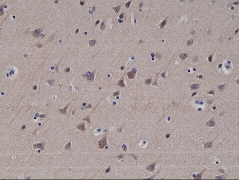 抗- LC3B 抗体，兔单克隆抗体 recombinant, expressed in HEK 293 cells, clone RM293, purified immunoglobulin