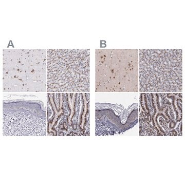 Anti-GOLIM4 antibody produced in rabbit Ab1, Prestige Antibodies&#174; Powered by Atlas Antibodies, affinity isolated antibody, buffered aqueous glycerol solution