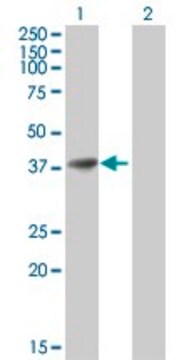 Anti-AKR1B1 antibody produced in mouse purified immunoglobulin, buffered aqueous solution