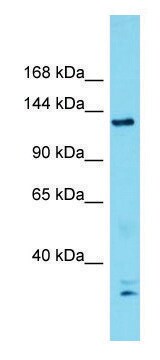 Anti-ERCC5 (N-terminal) antibody produced in rabbit affinity isolated antibody