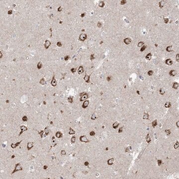 Anti-MARS2 antibody produced in rabbit Prestige Antibodies&#174; Powered by Atlas Antibodies, affinity isolated antibody, buffered aqueous glycerol solution