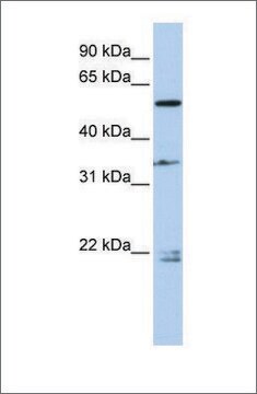 Anti-DPYSL2 antibody produced in rabbit affinity isolated antibody