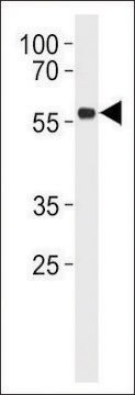 ANTI-P53 (S315) antibody produced in rabbit affinity isolated antibody, buffered aqueous solution