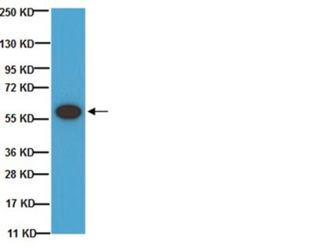 Anticuerpo anti-tirosina hidroxilasa, fosfoSer 40 Chemicon&#174;, from rabbit