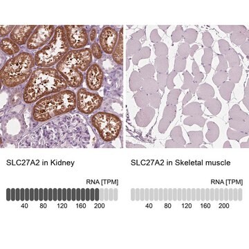 抗SLC27A2抗体 ウサギ宿主抗体 Prestige Antibodies&#174; Powered by Atlas Antibodies, affinity isolated antibody, buffered aqueous glycerol solution