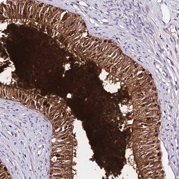 Anti-DEFB106B antibody produced in rabbit Prestige Antibodies&#174; Powered by Atlas Antibodies, affinity isolated antibody, buffered aqueous glycerol solution