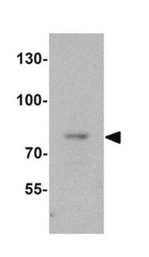 Anti-Fat Free Antibody from rabbit, purified by affinity chromatography