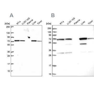 Anty-SDHA Prestige Antibodies&#174; Powered by Atlas Antibodies, affinity isolated antibody