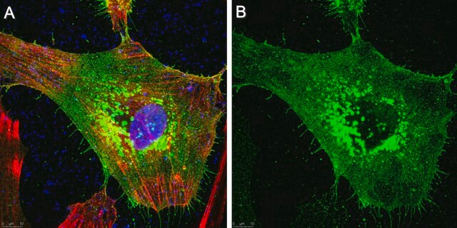 Anti-TM4SF1 Antibody