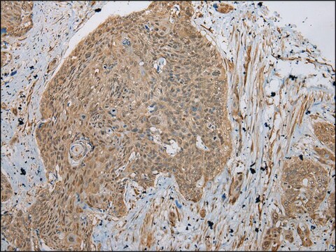 Anti-TBCA affinity isolated antibody