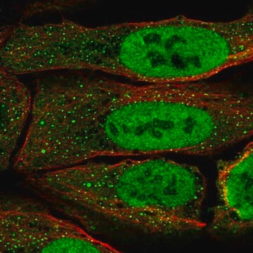 Anty-PAX5 Prestige Antibodies&#174; Powered by Atlas Antibodies, affinity isolated antibody