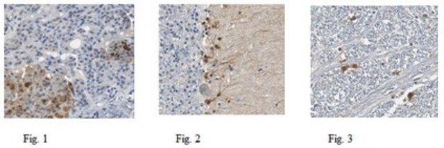 Anti-Trypsin-3 Antibody from rabbit, purified by affinity chromatography