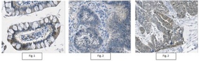 Anticorpo anti-forme mutanti di IDH1/2 (R132/172), clone MsMab-1 clone MsMAb-1, from mouse