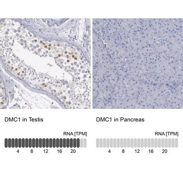 Anti-DMC1 antibody produced in rabbit Prestige Antibodies&#174; Powered by Atlas Antibodies, affinity isolated antibody, buffered aqueous glycerol solution