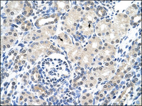 Anti-KRT17 antibody produced in rabbit affinity isolated antibody