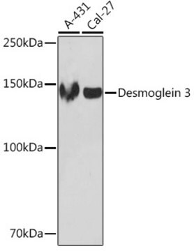 Anti-Desmoglein 3 Antibody, clone 1T1D5, Rabbit Monoclonal