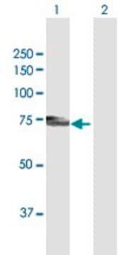 Anti-PLXDC1 antibody produced in mouse purified immunoglobulin, buffered aqueous solution