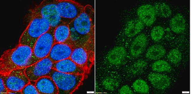 Anticorpo anti-recettore per gli estrogeni &#945; from rabbit, purified by affinity chromatography