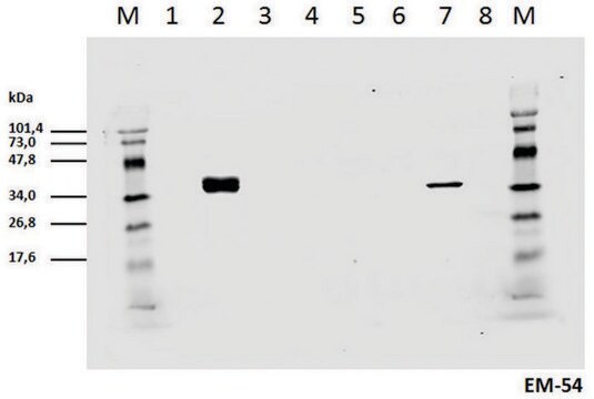 Monoclonal Anti-CD3 zeta (PhosphoTyr142) antibody produced in mouse clone EM-54