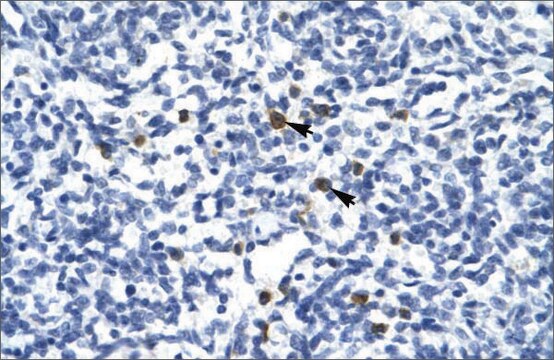 Anti-TAL1 (AB2) antibody produced in rabbit affinity isolated antibody