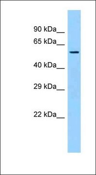 Anti-SQRDL antibody produced in rabbit affinity isolated antibody