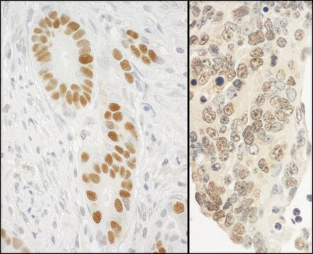 Rabbit anti-PCNA Antibody, Affinity Purified Powered by Bethyl Laboratories, Inc.