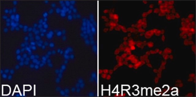 抗-组蛋白 H4R3me2a 兔抗 affinity isolated antibody