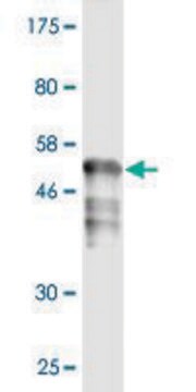 Monoclonal Anti-RAD51 antibody produced in mouse clone 4C11-B4, purified immunoglobulin, buffered aqueous solution