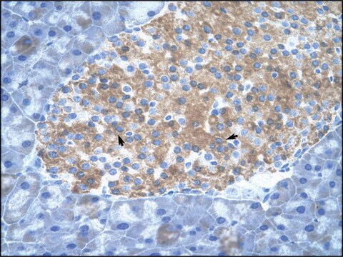 Anti-PIAS2 (AB1) antibody produced in rabbit affinity isolated antibody