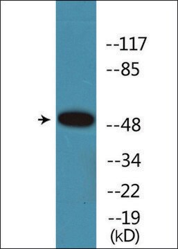 Anti-phospho-Retinoic Acid Receptor &#945; (pSer77) antibody produced in rabbit affinity isolated antibody