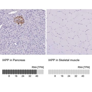 Anti-IAPP antibody produced in rabbit Prestige Antibodies&#174; Powered by Atlas Antibodies, affinity isolated antibody, buffered aqueous glycerol solution