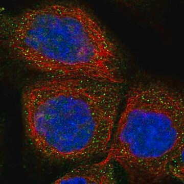 Anti-FXYD1 antibody produced in rabbit Prestige Antibodies&#174; Powered by Atlas Antibodies, affinity isolated antibody, buffered aqueous glycerol solution