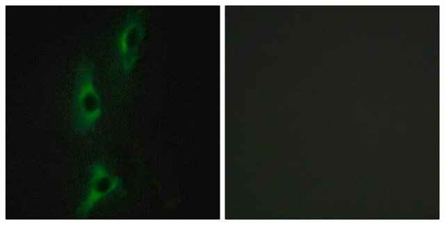 Anti-ADRB2 antibody produced in rabbit affinity isolated antibody