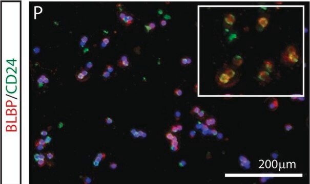 Anticorpo anti-proteina legante i lipidi cerebrali from rabbit, purified by affinity chromatography