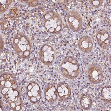 Anti-PEMT antibody produced in rabbit Prestige Antibodies&#174; Powered by Atlas Antibodies, affinity isolated antibody, buffered aqueous glycerol solution