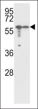 ANTI-VIMENTIN (CENTER) antibody produced in rabbit purified immunoglobulin, buffered aqueous solution