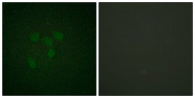 Anti-p53 (Acetyl-Lys317), C-Terminal antibody produced in rabbit affinity isolated antibody