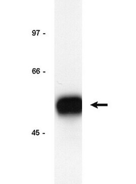 Anti-E2F-1 Antibody, clones KH20 and KH95 Upstate&#174;, from mouse