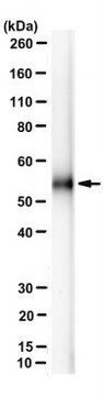 Anti-ANTXR2/CMG-2 Antibody, clone 1H8