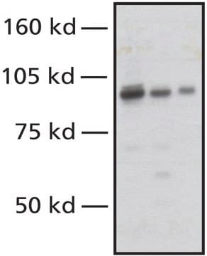 Anti-NBS1 (Nibrin), C-terminal antibody produced in rabbit affinity isolated antibody, buffered aqueous solution